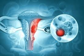 6. Gynecologic & Women’s Cancers