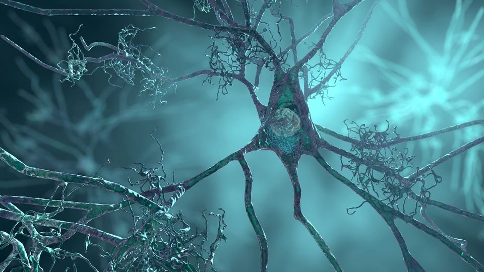 15. Neurodegeneration and Metabolism