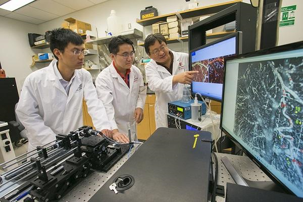 Stroke & Cerebrovascular Innovation