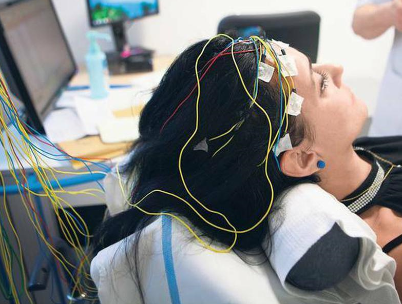 Intelligent EEG & Epilepsy