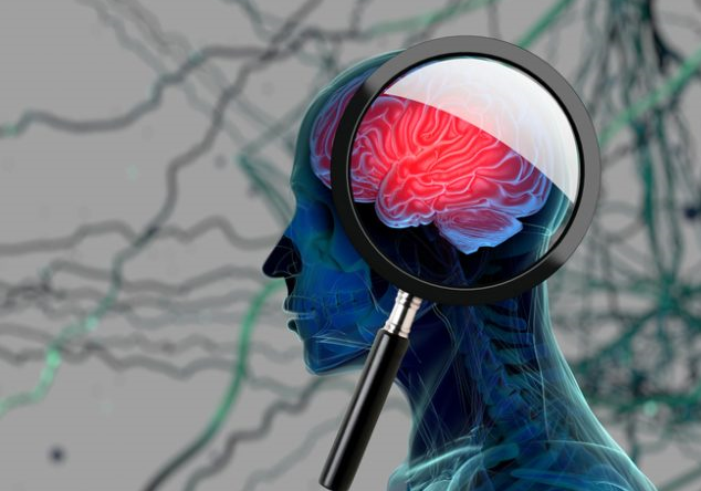 Precision Dementia & Cognitive Neuroscience