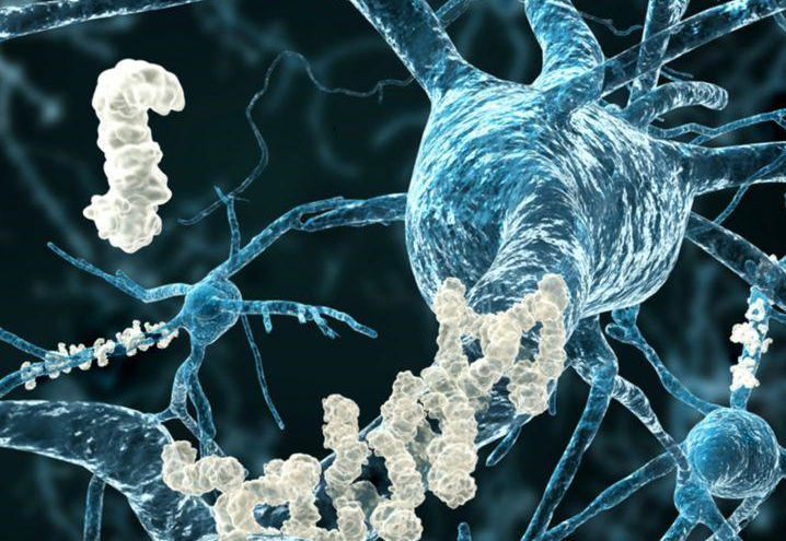 Neurodegeneration & Disease Modification
