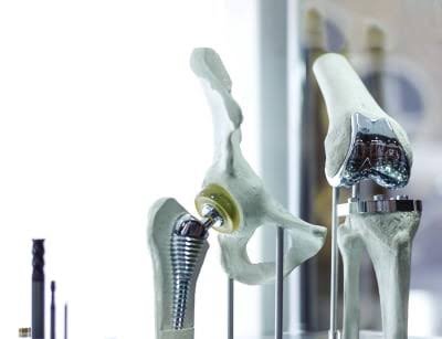 9. Medical Implants, Prosthetics and Personalized Medicine